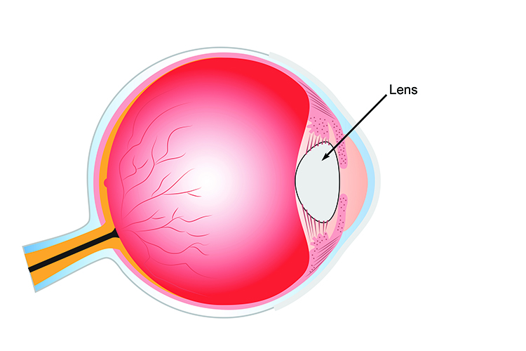 The lens is positioned behind the retina and focuses light from different distances